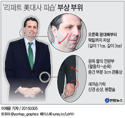 리퍼트 대사 피습후 수술까지…긴박했던 5시간(종합) - 2