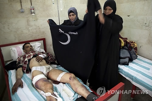 시리아 정부군에 고문당한 뒤 버려진 민간인