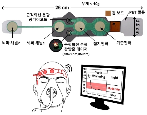 무선 마취 심도 모니터링 측정기 구성