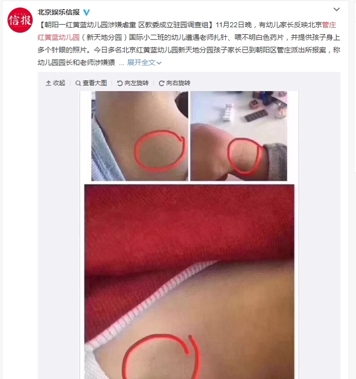 중국 웨이보에 올라온 유치원 아동학대 피해 글.[웨이보 캡처]