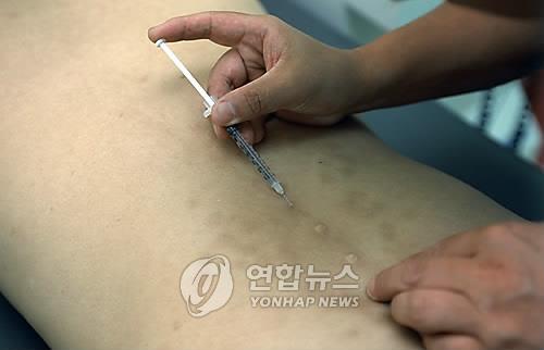봉독요법
