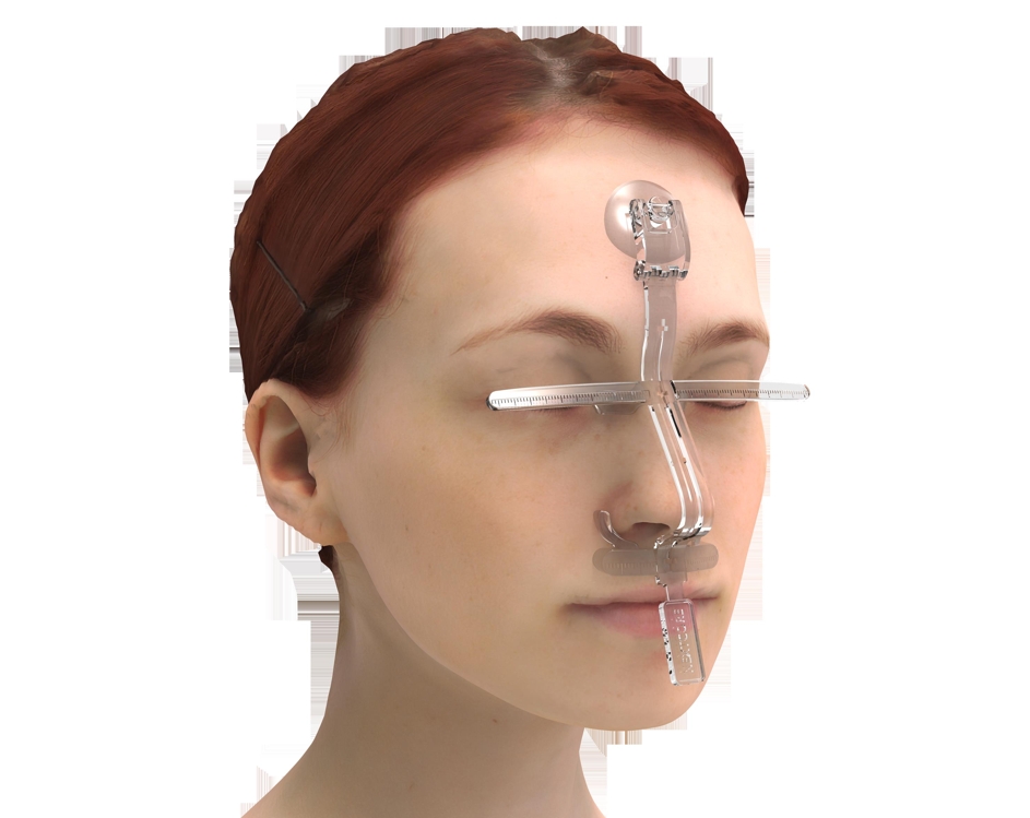 3D 프린팅으로 만든 '환자맞춤형 코 성형수술 가이드' 사용하는 이미지. [울산대병원 제공. 재판매 및 DB 금지]
