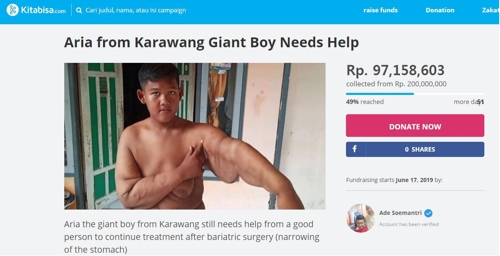 추가 수술을 위한 크라우드 펀딩