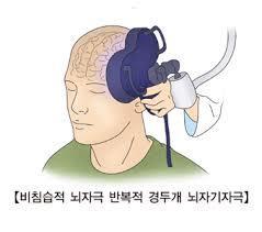 경두개 뇌 자기 자극 장치