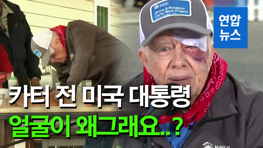 [영상] '붓고 멍든 눈'…95세 지미 카터, 14바늘 꿰매고도 봉사활동 - 2