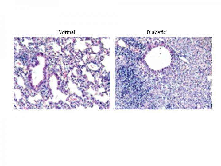 메르스 감염 21일 후 정상 생쥐(좌측)의 폐 염증이 훨씬 빨리 해소됐다. 