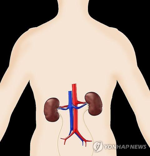 신장질환(일러스트)