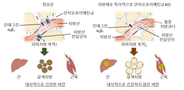 건강한 비만과 건강하지 않은 비만의 대사적인 비교