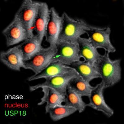 USP18 억제 인자