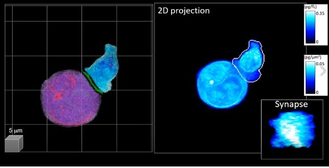 암세포(보라색)를 인지하는 CAR-T 세포(파란색)의 3차원 영상