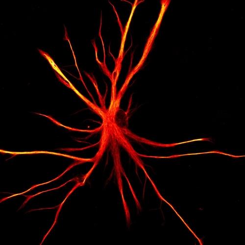 인간 유도만능줄기세포(iPSCs)에서 유래한 성상교세포 