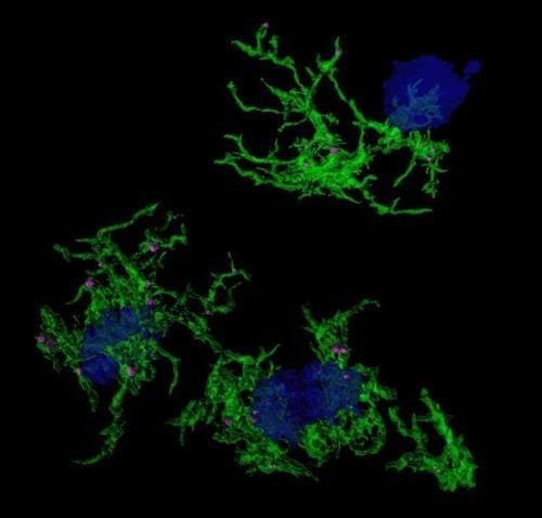알츠하이머병의 원인 물질인 아밀로이드 플라크(청색)를 삼키는 소교세포(녹색)