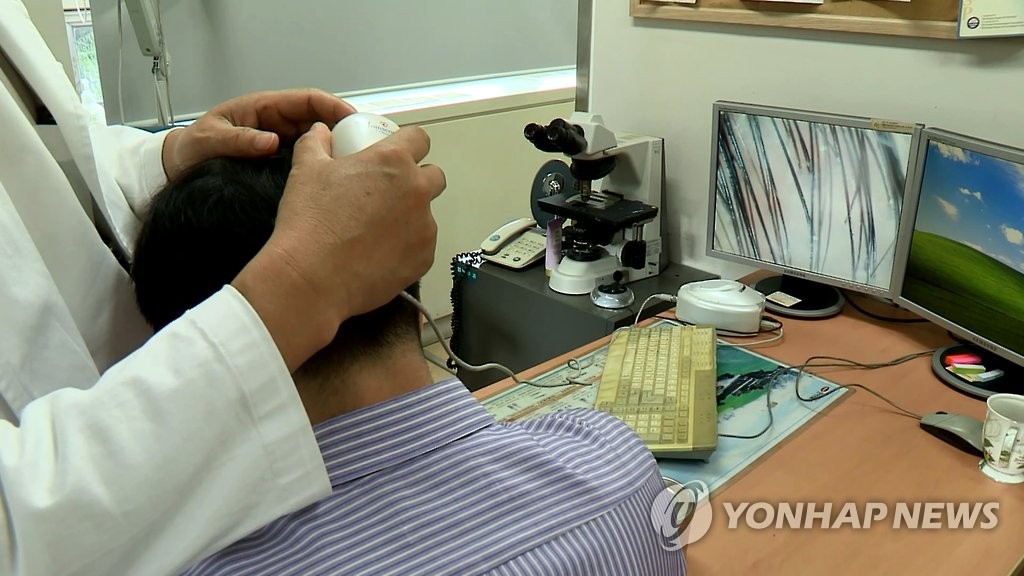 탈모 치료