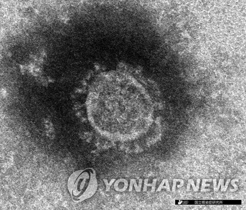 일본 국립감염증연구소가 분리한 코로나19 전자현미경 사진