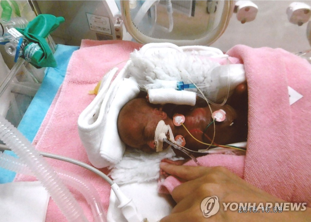 JAPAN-HEALTH-INFANTS