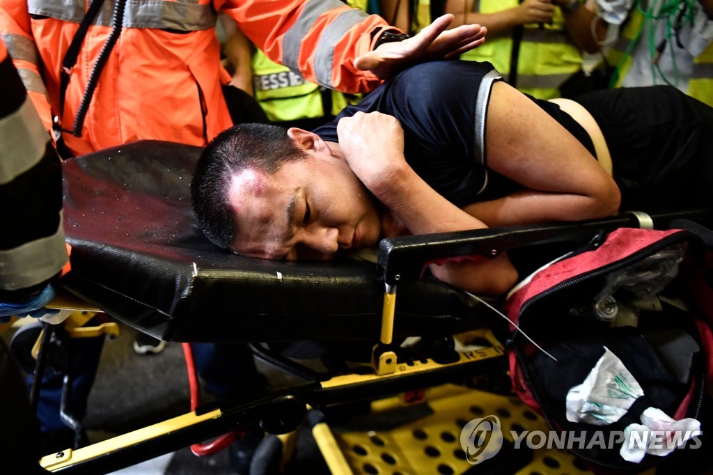 HONG KONG-CHINA-POLITICS-UNREST