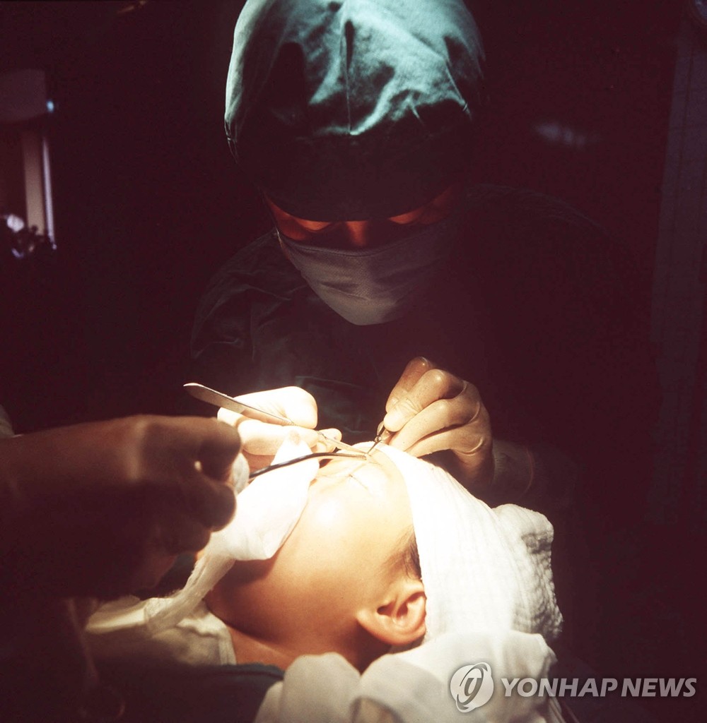 쌍꺼풀 수술