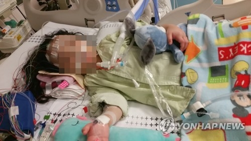 This photo, provided by the mother of the bedridden girl, shows the four-year-old being treated at an intensive care unit for acute kidney failure, known as HUS. Her family has sued the local unit of McDonald's for serving undercooked meat in the Happy Meal burger which her daughter had before she was diagnosed with the disease. (Yonhap) 