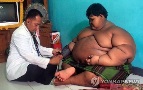 세계 가장 뚱뚱한 10살, 인도네시아 정부가 감량 나섰다 - 2