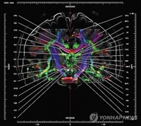 의식은 어떻게 형성될까…'뇌 활성' 패턴 발견