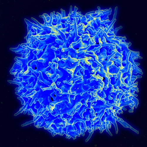 인간 T세포의 전자 현미경 사진[위키피디아 갈무리. 재판매 및 DB 금지]