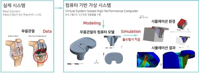 인공무릎관절의 컴퓨터 모델링 및 시뮬레이션 과정 예시