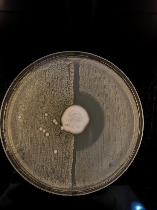 Trichophyton erinasei (center) and methicillin-resistant Staphylococcus aureus (MRSA, left)