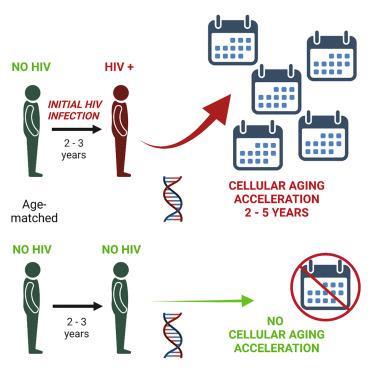 HIV 감염과 노화 촉진