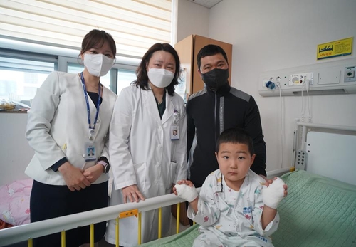 합지증 분리 수술 마친 몽골인 아동