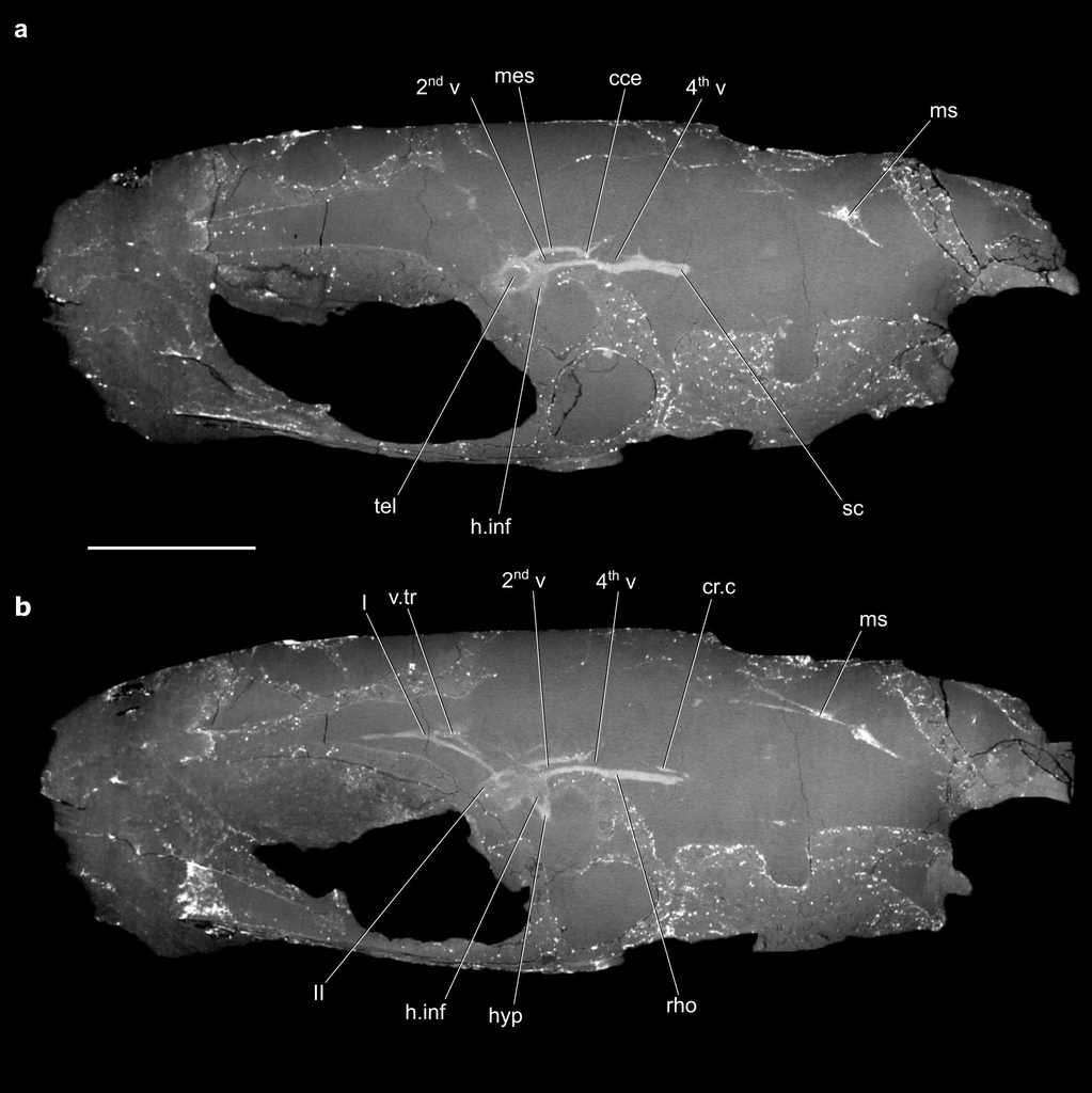 컴퓨터 단층촬영(CT)으로 확인된 C.와일디 두개골 내부 뇌 구조