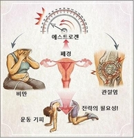  여성 100명 중 1∼2명꼴 '조기폐경'…"당뇨병 위험↑"