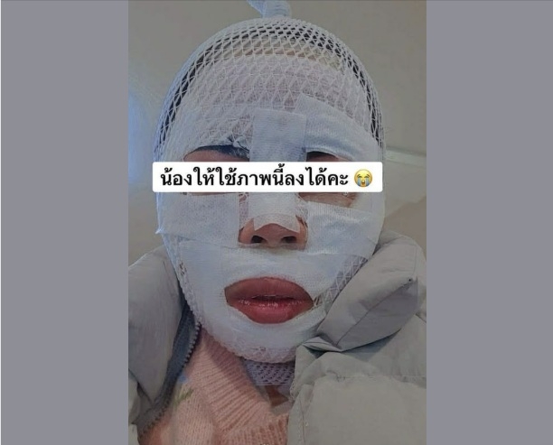 화상 입은 태국인 아내