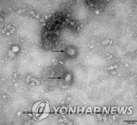 전자현미경 통해 본 중국 우한 코로나바이러스.