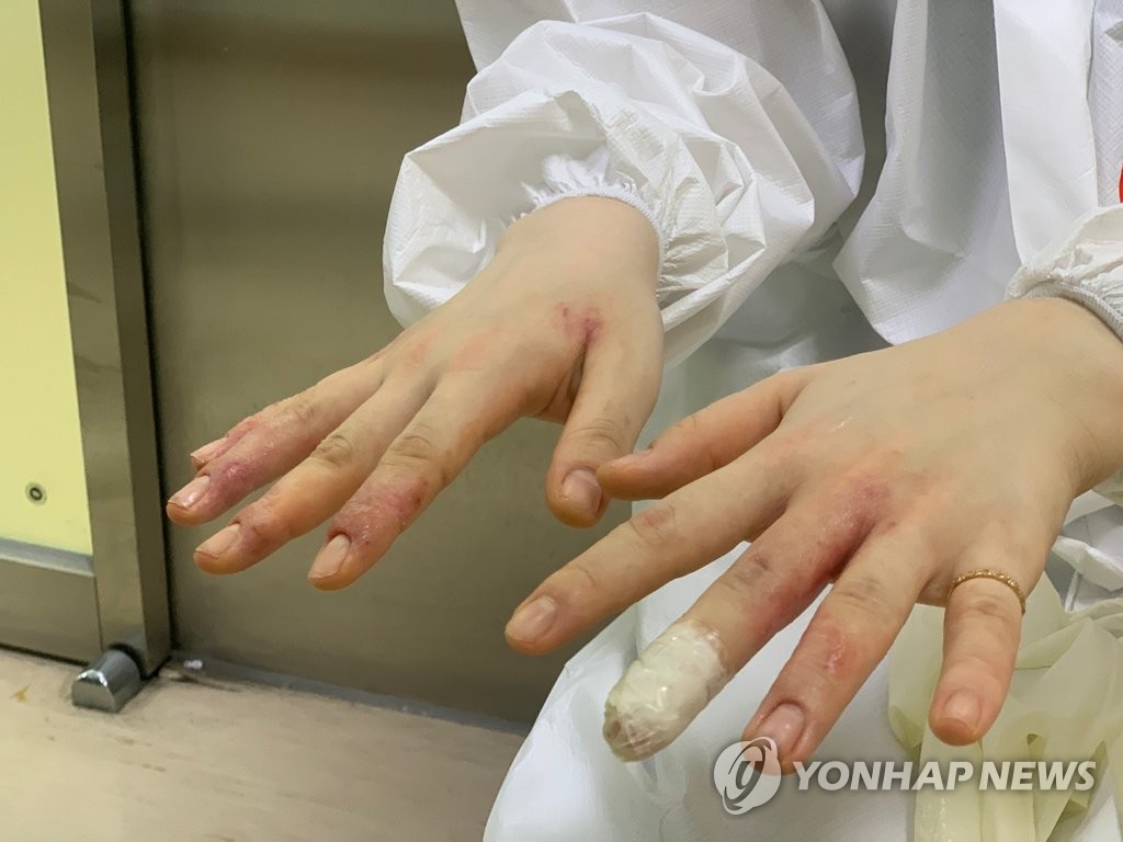 코로나19와 고군분투하는 의료진의 손